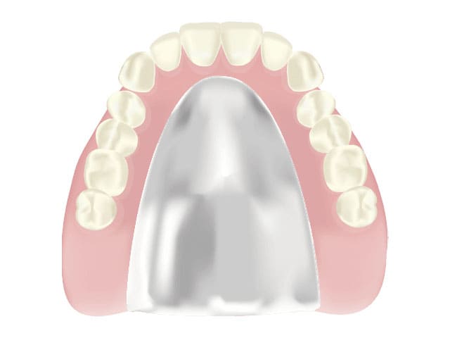 コバルトクロム床義歯